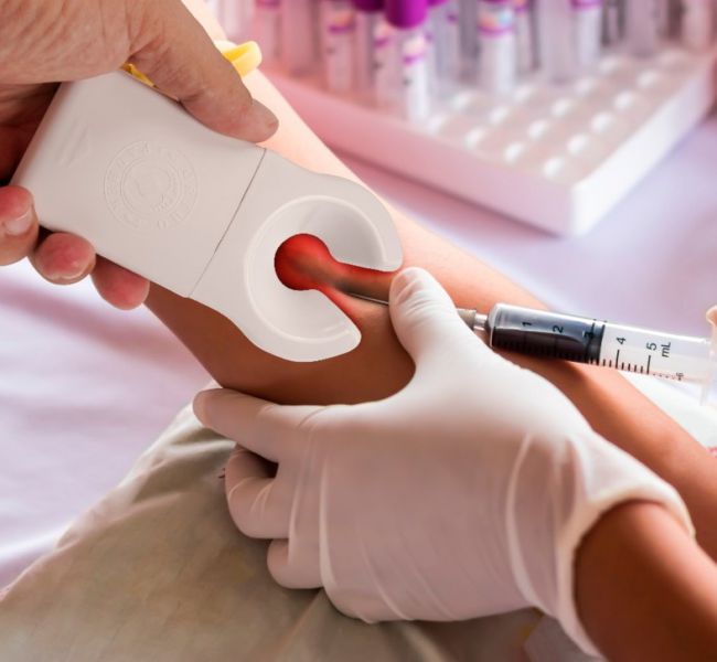 Fleboscópio Acha Veia